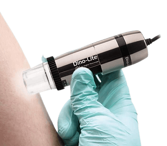 Dermatoscope